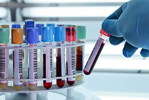 Blood tubes for centrifuging