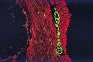Immunohistochemistry Kits