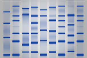 Western Blot Kits