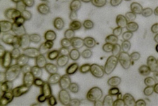 Yeast Product Z1000 -- Zymolase